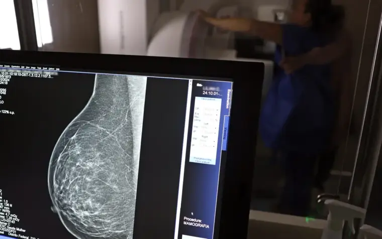 Mamografia digital será coberta por plano de saúde para todos