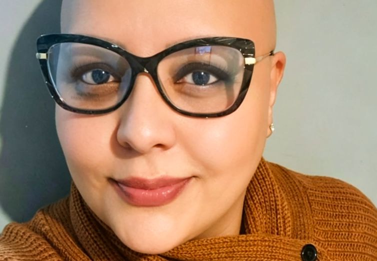 Alopecia areata e a busca de pacientes pela autoestima